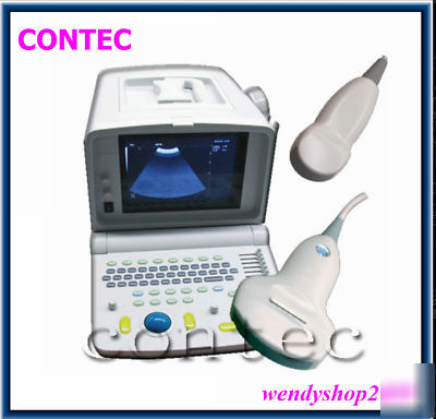 Portable ultrasound scanner ultrasound 3.5MHZ convex