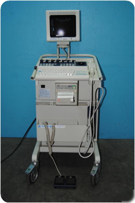 Atl um 4 plus diagnostic ultrasound (b/w doppler)