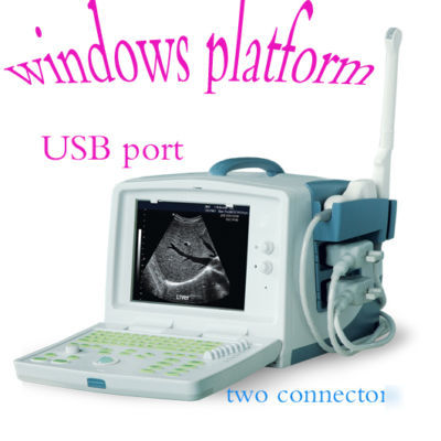 New full digital ultrasound scanner ultraound machine