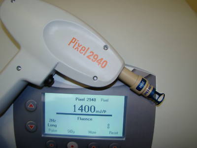 Alma harmony pixel fractional laser 4 handpieces total