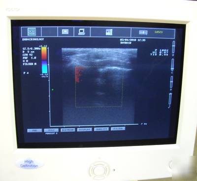 Esaote high definition picus color ultrasound w/ probe 
