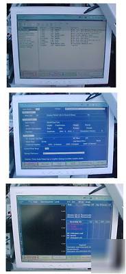 Nicolet viking select emg neurodiagnostic system