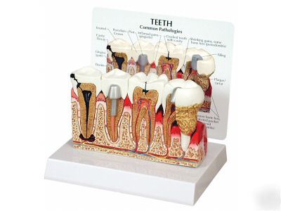 Teeth human anatomical model dental #2860 free s&h*