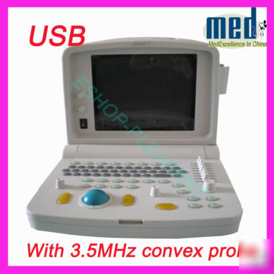 New ultrasound scanner ultrasound machine+ convex probe 