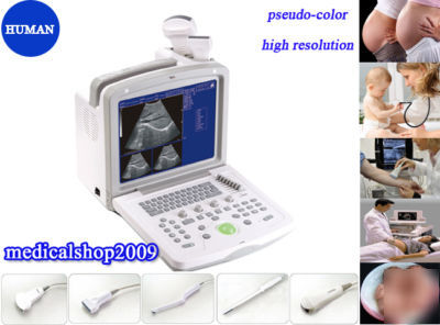 Portable ultrasound scanner ultrasound system + convex 