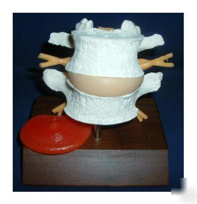 Lumbar spine vertebrae anatomical model chiropractic