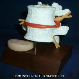 Lumbar spine vertebrae anatomical model chiropractic