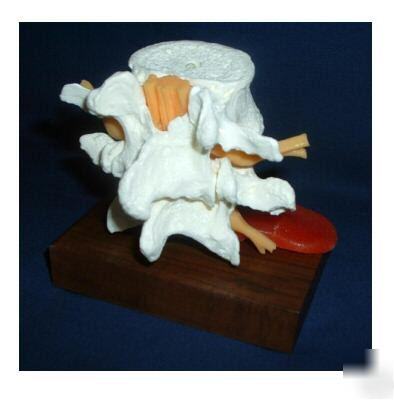 Lumbar spine vertebrae anatomical model chiropractic