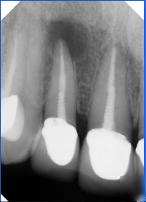 Xdr digital x-ray sensor system.. installed must see