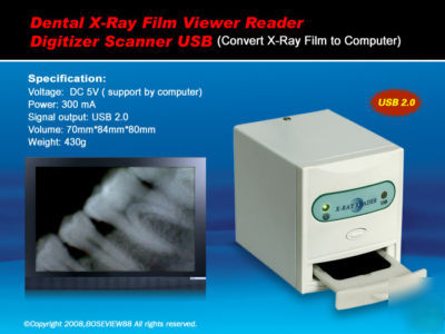 New brand x-ray film viewer digitizer scanner reader us