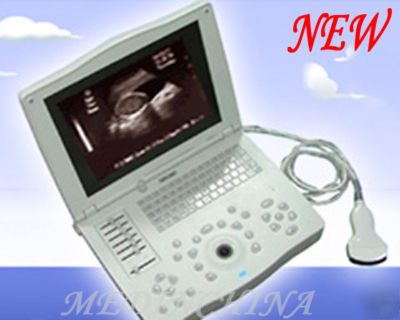 Portable ultrasound scanner/machine+6.5MHZ linear probe